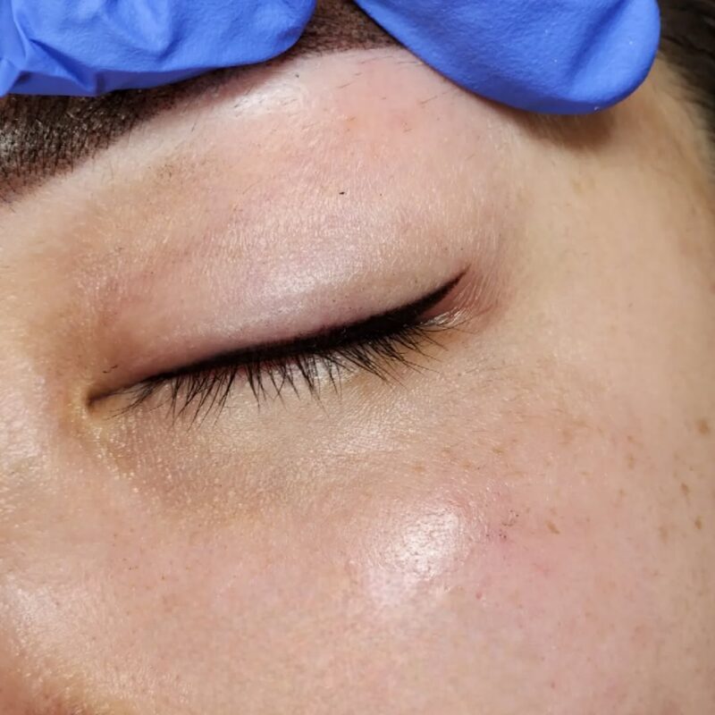 Eyeliner Cosmetic Tattoo