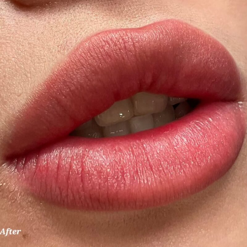 Lips Cosmetic Tattoo